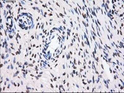 Immunohistochemistry: BTN3A2 Antibody (OTI1A6) - Azide and BSA Free [NBP2-71678]