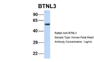 Western Blot: BTNL3 Antibody [NBP1-69346]