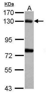 Western Blot: Bub1 Antibody [NBP1-31584]