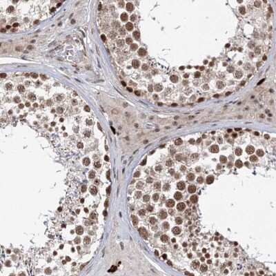 Immunohistochemistry: BUD13 Antibody [NBP2-38407]