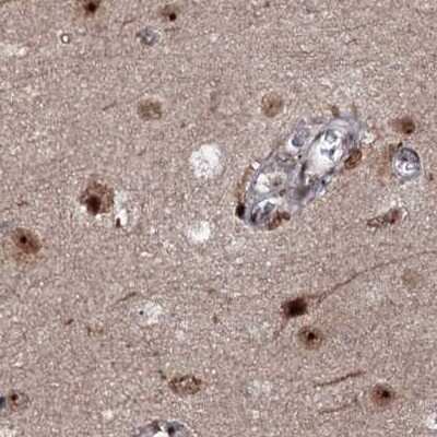 Immunohistochemistry-Paraffin: BUD13 Antibody [NBP1-81863]