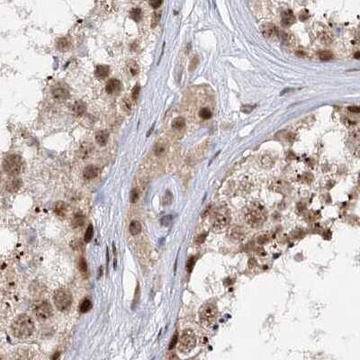 Immunohistochemistry-Paraffin: BUD13 Antibody [NBP1-81863]