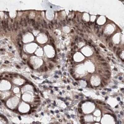 Immunohistochemistry-Paraffin: BUD13 Antibody [NBP1-81863]