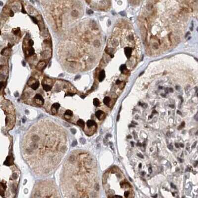 Immunohistochemistry-Paraffin: BUD13 Antibody [NBP1-81863]