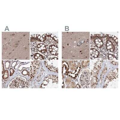 Immunohistochemistry-Paraffin: BUD13 Antibody [NBP2-38407]