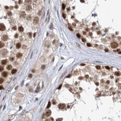 Immunohistochemistry-Paraffin: BUD13 Antibody [NBP2-38407]