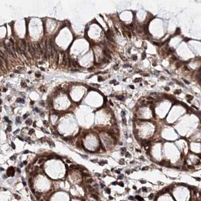 Immunohistochemistry-Paraffin: BUD13 Antibody [NBP2-38407]