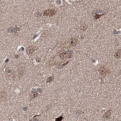 Immunohistochemistry-Paraffin: BUD13 Antibody [NBP2-38407]