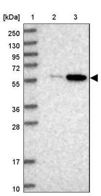 Western Blot: BUD13 Antibody [NBP1-81863]