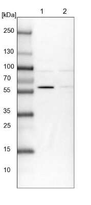 Western Blot: BUD13 Antibody [NBP1-81863]