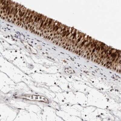 Immunohistochemistry-Paraffin: BUD31 Antibody [NBP1-84010]