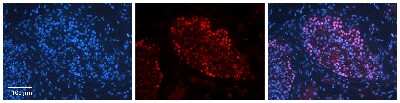 Immunohistochemistry-Paraffin: BUD31 Antibody [NBP3-10475]
