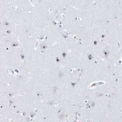 Immunohistochemistry-Paraffin: BXDC1 Antibody [NBP1-90031]