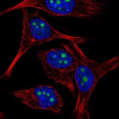 Immunocytochemistry/ Immunofluorescence: BXDC5 Antibody [NBP1-89915]