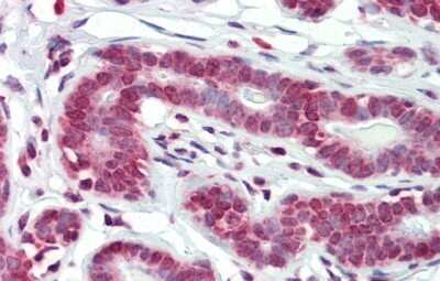 Immunohistochemistry-Paraffin: BXDC5 Antibody [NBP1-80467]