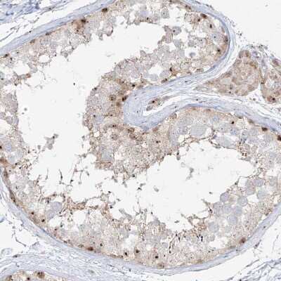 Immunohistochemistry-Paraffin: BYSL Antibody [NBP1-89501]