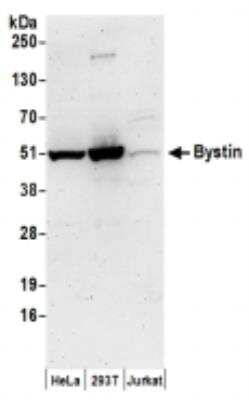 Western Blot: BYSL Antibody [NBP2-36532]