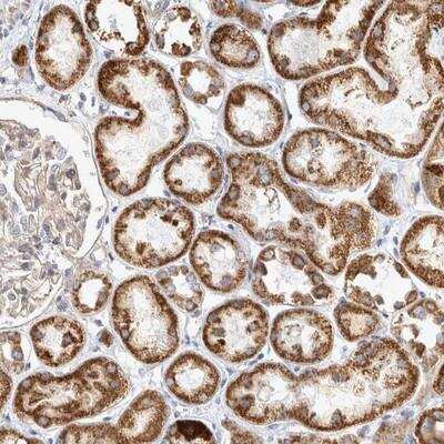 Immunohistochemistry: BZRAP1 Antibody [NBP1-93626]