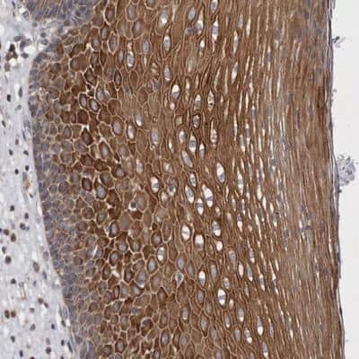 Immunohistochemistry: BZRAP1 Antibody [NBP1-93627]