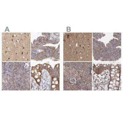 Immunohistochemistry-Paraffin: BZRAP1 Antibody [NBP1-93626]