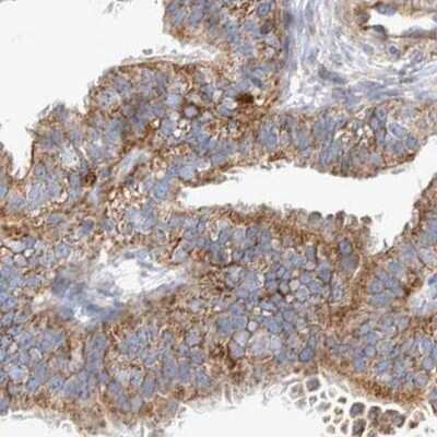 Immunohistochemistry-Paraffin: BZRAP1 Antibody [NBP1-93626]