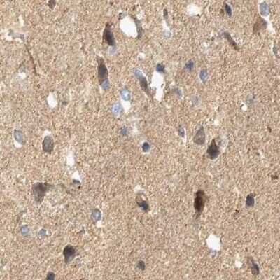 Immunohistochemistry-Paraffin: BZRAP1 Antibody [NBP1-93626]