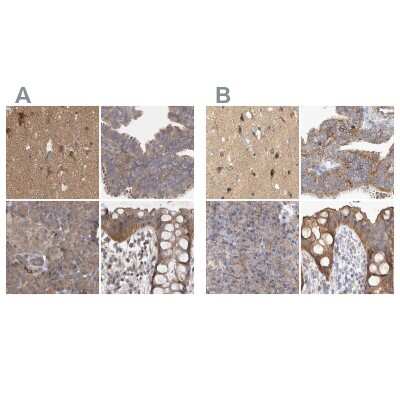 Immunohistochemistry-Paraffin: BZRAP1 Antibody [NBP1-93627]