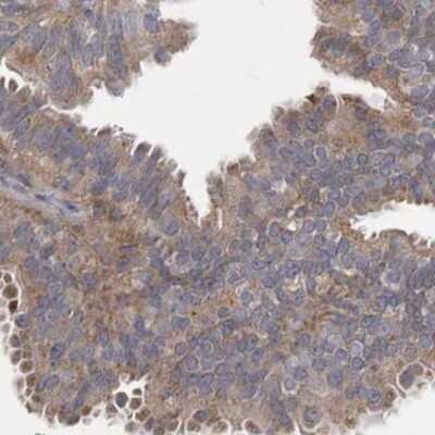 Immunohistochemistry-Paraffin: BZRAP1 Antibody [NBP1-93627]