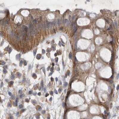 Immunohistochemistry-Paraffin: BZRAP1 Antibody [NBP1-93627]