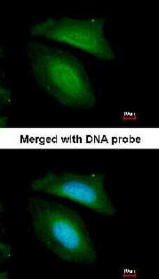 Immunocytochemistry/ Immunofluorescence: BZW2 Antibody [NBP1-32519]
