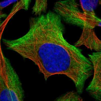 Immunocytochemistry/ Immunofluorescence: BZW2 Antibody [NBP1-83182]
