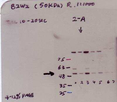 Western Blot: BZW2 Antibody [NBP1-32519]