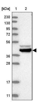 Western Blot: BZW2 Antibody [NBP1-83182]