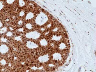 Immunohistochemistry: Bag-1 Antibody (RM356) [NBP2-77438]