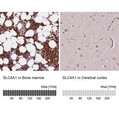 Immunohistochemistry-Paraffin: Band 3 Antibody [NBP2-49409]