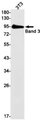 Western Blot: Band 3 Antibody (S07-8A4) [NBP3-19579]