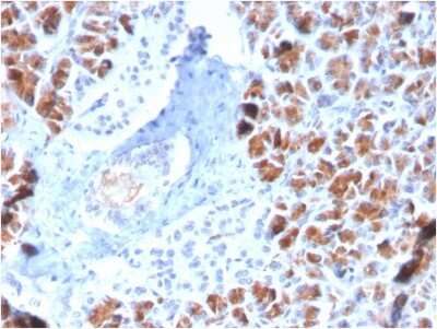 Immunohistochemistry-Paraffin: BarX1 Antibody (BARX1/2759) [NBP3-07702]