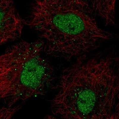 Immunocytochemistry/ Immunofluorescence: BarX1 Antibody [NBP2-58378]
