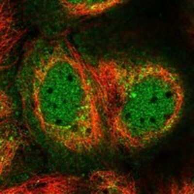 Immunocytochemistry/ Immunofluorescence: BarX2 Antibody [NBP3-17808]
