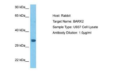 Western Blot: BarX2 Antibody [NBP2-84496]