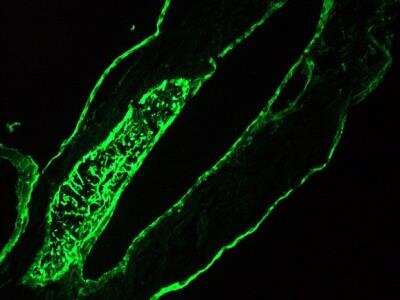 Immunocytochemistry/ Immunofluorescence: Basal cell cytokeratin Antibody (RCK103) - BSA Free [NBP1-97729]