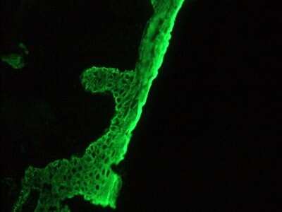 Immunohistochemistry-Frozen: Basal cell cytokeratin Antibody (RCK103) - BSA Free [NBP1-97729]