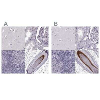 Immunohistochemistry-Paraffin: Basalin Antibody [NBP1-80806]