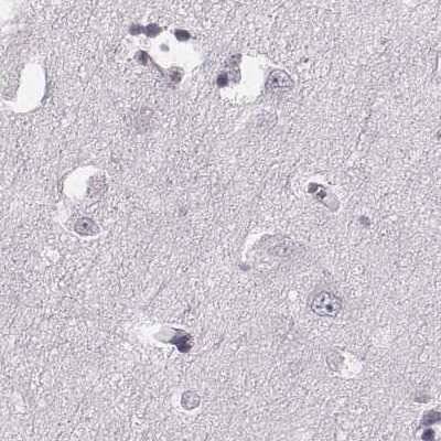 Immunohistochemistry-Paraffin: Basalin Antibody [NBP1-80806]