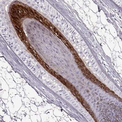 Immunohistochemistry-Paraffin: Basalin Antibody [NBP2-56332]