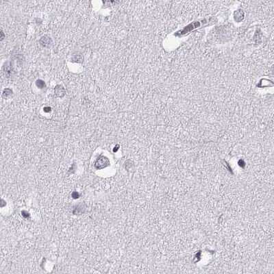 Immunohistochemistry-Paraffin: Basalin Antibody [NBP2-56332]