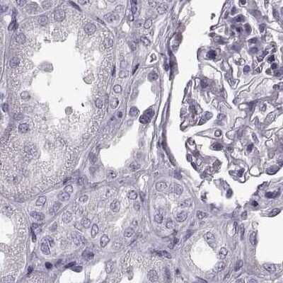 Immunohistochemistry-Paraffin: Basalin Antibody [NBP2-56332]
