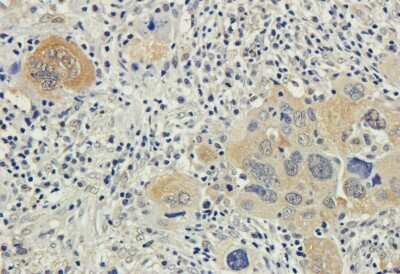Immunohistochemistry: Bax Antibody (6A7) - Chimeric - Azide and BSA Free [NBP3-08985]