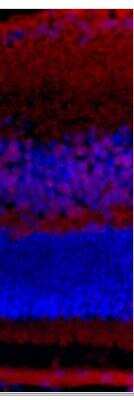 Immunohistochemistry-Frozen: Bax Antibody (6A7) [NBP1-28566]