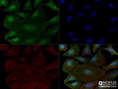 Immunocytochemistry/ Immunofluorescence: Bax inhibitor 1 Antibody (20F248) - Azide and BSA Free [NBP2-80592]